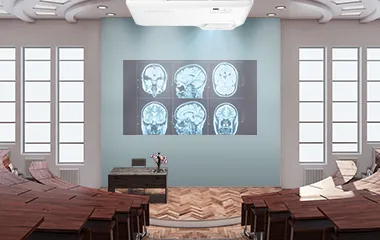 ViewSonic projector displaying image of an x-ray on a wall